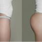 Butt Shots using Body Fillers.