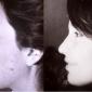 Chin Enhancement & Rhinoplasty