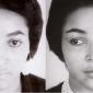 Rhinoplasty